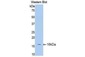 Western Blotting (WB) image for anti-Interleukin 18 Receptor 1 (IL18R1) (AA 147-255) antibody (ABIN1174878) (IL18R1 抗体  (AA 147-255))