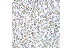 Immunohistochemistry of paraffin-embedded human liver using CPS1 Rabbit mAb (ABIN7266063) at dilution of 1:100 (40x lens). (CPS1 抗体)