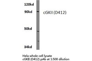 Western blot (WB) analysis of cGKii antibody  in extracts from hela cells. (PRKG2 抗体)