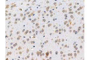 ABIN6257633 and ABIN6274769 at 1/100 staining Mouse brain tissue by IHC-P. (RPL15 抗体  (C-Term))