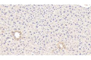Detection of GCK in Mouse Liver Tissue using Polyclonal Antibody to Glucokinase (GCK) (GCK 抗体  (AA 3-226))