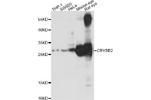 Western blot analysis of extracts of various cell lines,ing CRYBB2 antibody (ABIN1876777) at 1:1000 dilution. (CRYbB2 抗体)