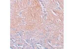 Immunohistochemical staining of human brain cells with CXXC5 polyclonal antibody  at 2. (CXXC5 抗体  (N-Term))