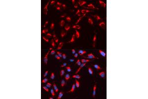 Immunofluorescence (IF) image for anti-Neural Wiskott-Aldrich syndrome protein (WASL) antibody (ABIN1875345) (Neural Wiskott-Aldrich syndrome protein (WASL) 抗体)