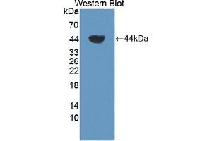 Detection of Recombinant TCN1, Human using Polyclonal Antibody to Transcobalamin I (TCN1) (TCN1 抗体  (AA 24-433))
