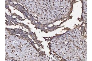 IHC analysis of ANXA4 using anti-ANXA4 antibody (ABIN5518805).
