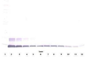 Image no. 1 for anti-Chemokine (C-C Motif) Ligand 7 (CCL7) antibody (ABIN465455) (CCL7 抗体)