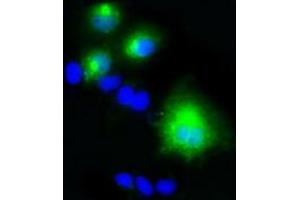 Image no. 3 for anti-Lipase, Endothelial (LIPG) antibody (ABIN1499160) (LIPG 抗体)