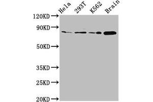 Western Blot Positive WB detected in: Hela whole cell lysate, 293T whole cell lysate, K562 whole cell lysate, Rat brain tissue All lanes: MKLN1 antibody at 2. (MKLN1 抗体  (AA 488-614))