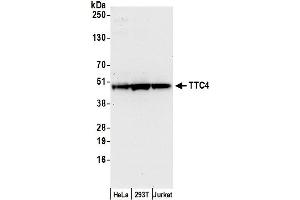 anti-Tetratricopeptide Repeat Domain 4 (TTC4) (AA 1-50) antibody