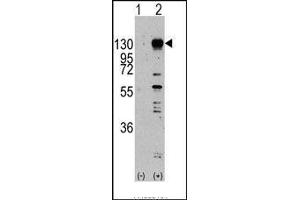 Western blot analysis of FGFR1 (arrow) using rabbit polyclonal FGFR1 Antibody.
