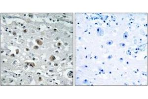 Immunohistochemistry analysis of paraffin-embedded human brain tissue, using GASP1 Antibody. (GPRASP1 抗体  (AA 741-790))
