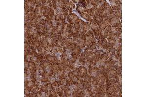 Immunohistochemical staining of human pancreas with DNAH10 polyclonal antibody  shows strong cytoplasmic positivity in exocrine glandular cells at 1:200-1:500 dilution. (DNAH10 抗体)