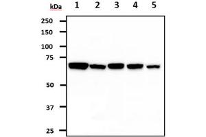 The cell lysates (40ug) were resolved by SDS-PAGE, transferred to PVDF membrane and probed with anti-human GARS (1:1000). (GARS 抗体)