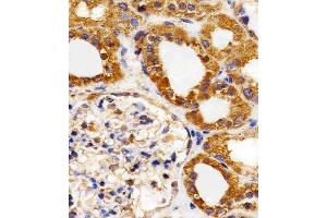 Paraformaldehyde-fixed, paraffin embedded Human Kidney tissue, Antigen retrieval by boiling in sodium citrate buffer (pH6. (FLT4 抗体)