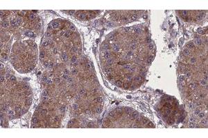 ABIN6277715 at 1/100 staining Human kidney tissue by IHC-P. (Nephrin 抗体)