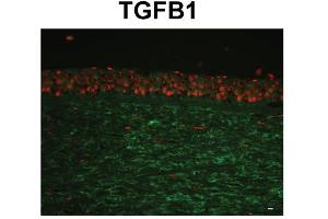 Species, Tissue/Cell Type:Human Cornea tissue (epithelium and stroma) Primary used and dilution: 1:400 (TGFBI 抗体  (C-Term))