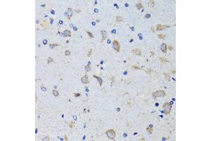 Immunohistochemistry of paraffin-embedded mouse brain using PTPN1 antibody (ABIN5970769) at dilution of 1/100 (40x lens). (PTPN1 抗体)