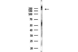 Western blot analysis of lysates from Hela cells(LPS 4h treatment), using TANC2 Antibody at 1/1000 dilution. (TANC2 抗体)