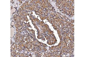 IHC analysis of GPR54/KISS1R using anti-GPR54/KISS1R antibody (ABIN7602153).