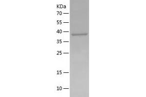 Western Blotting (WB) image for Chemokine (C-C Motif) Receptor-Like 2 (CCRL2) (AA 171-344) protein (His-IF2DI Tag) (ABIN7283850) (CCRL2 Protein (AA 171-344) (His-IF2DI Tag))