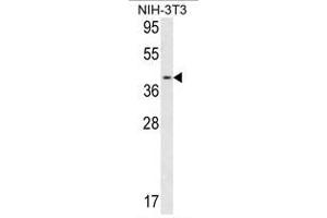 Image no. 1 for anti-Calponin 3, Acidic (CNN3) (Middle Region) antibody (ABIN452801) (CNN3 抗体  (Middle Region))