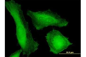 Immunofluorescence of purified MaxPab antibody to TPD52 on HeLa cell. (TPD52 抗体  (AA 1-184))