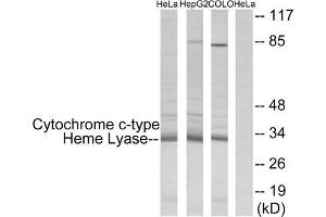 Western Blotting (WB) image for anti-Holocytochrome C Synthase (HCCS) (Internal Region) antibody (ABIN6300069) (HCCS 抗体  (Internal Region))