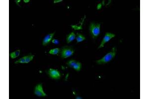 Immunofluorescence staining of U251 cells with ABIN7161318 at 1:200, counter-stained with DAPI. (Neuroligin 3 抗体  (AA 642-783))