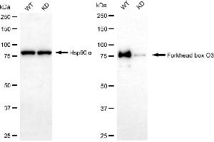 Western blotting analysis using forkhead box O3 antibody (ABIN7798646). (Recombinant FOXO3 抗体)