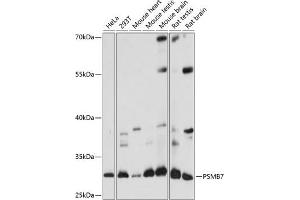 Western Blotting (WB) image for anti-Proteasome (Prosome, Macropain) Subunit, beta Type, 7 (PSMB7) (AA 44-200) antibody (ABIN7269594)