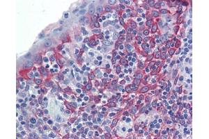 LIN7C antibody was used for immunohistochemistry at a concentration of 4-8 ug/ml. (LIN7C 抗体)