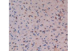 Used in DAB staining on fromalin fixed paraffin-embedded Liver tissue (MST1 抗体  (AA 469-704))