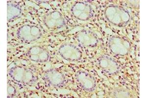 Immunohistochemistry of paraffin-embedded human colon tissue using ABIN7147595 at dilution of 1:100 (Cholecystokinin 抗体  (AA 21-115))