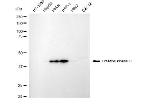 Western blotting analysis using creatine kinase B antibody (ABIN7798163). (Recombinant CKB 抗体)