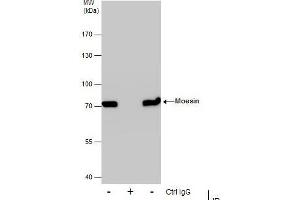IP Image Immunoprecipitation of Moesin protein from A431 whole cell extracts using 5 μg of Moesin antibody [C2C3], C-term, Western blot analysis was performed using Moesin antibody [C2C3], C-term, EasyBlot anti-Rabbit IgG  was used as a secondary reagent. (Moesin 抗体  (C-Term))