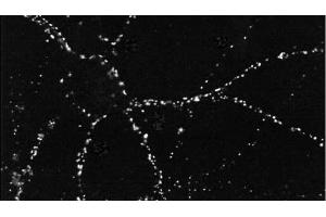 Immunocytochemistry/Immunofluorescence analysis using Mouse Anti-PSD95 Monoclonal Antibody, Clone 6G6 . (DLG4 抗体  (APC))