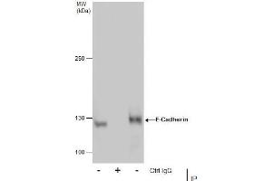 IP Image Immunoprecipitation of E-Cadherin protein from MCF-7 whole cell extracts using 5 μg of E-Cadherin antibody, Western blot analysis was performed using E-Cadherin antibody, EasyBlot anti-Rabbit IgG  was used as a secondary reagent. (E-cadherin 抗体)
