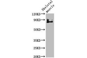 Western Blot Positive WB detected in: Mouse skeletal muscle tissue All lanes: TRPV2 antibody at 4. (TRPV2 抗体  (AA 1-117))