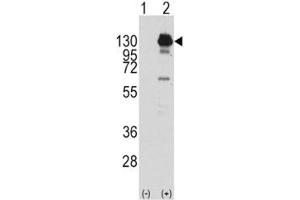 Western blot analysis of PDGFR alpha antibody and 293 cell lysate (2 ug/lane) either nontransfected (Lane 1) or transiently transfected with the human gene (2). (PDGFRA 抗体  (AA 740-769))