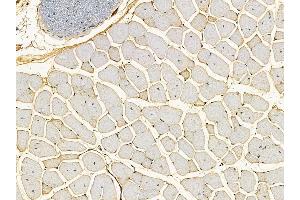 ABIN7095499 and ABIN7099556 at 1/100 staining mouse muscle tissue by IHC-P. (SMCR8 抗体)