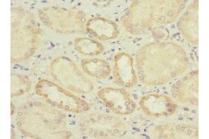 Immunohistochemistry of paraffin-embedded human kidney tissue using ABIN7156807 at dilution of 1:100 (IL17 Receptor B 抗体  (AA 18-292))