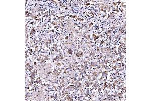 IHC analysis of RAB3GAP1 using anti-RAB3GAP1 antibody (ABIN7599702).