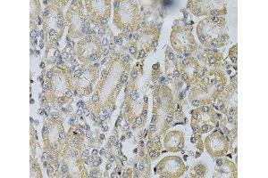Immunohistochemistry of paraffin-embedded Rat kidney using PDGFB Polyclonal Antibody at dilution of 1:100 (40x lens). (PDGFB 抗体)