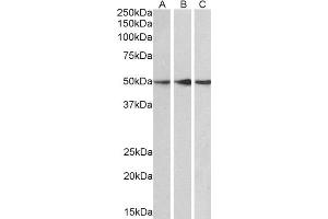 ABIN2564672 (0. (PPP2R5E 抗体  (C-Term))