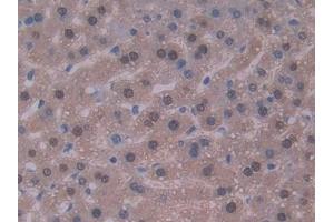 DAB staining on IHC-P; Samples: Mouse Liver Tissue (IL-22 抗体  (AA 34-179))