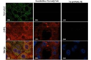Immunohistochemistry of Rabbit anti-Sprouty2 antibody. (SPRY2 抗体  (Internal Region))