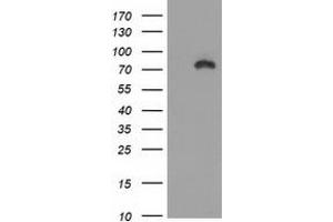 Image no. 2 for anti-Catenin (Cadherin-Associated Protein), beta 1, 88kDa (CTNNB1) antibody (ABIN1496891) (CTNNB1 抗体)