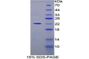 SDS-PAGE analysis of Human CLEC4M Protein. (C-Type Lectin Domain Family 4, Member M (CLEC4M) 蛋白)