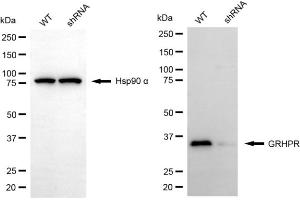 anti-Glyoxylate Reductase/hydroxypyruvate Reductase (GRHPR) antibody